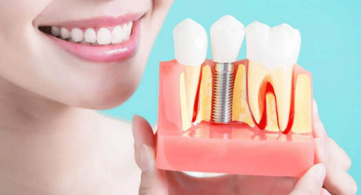 sonho-implantes-dentario