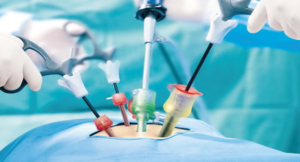 video-cirurgia-coluna