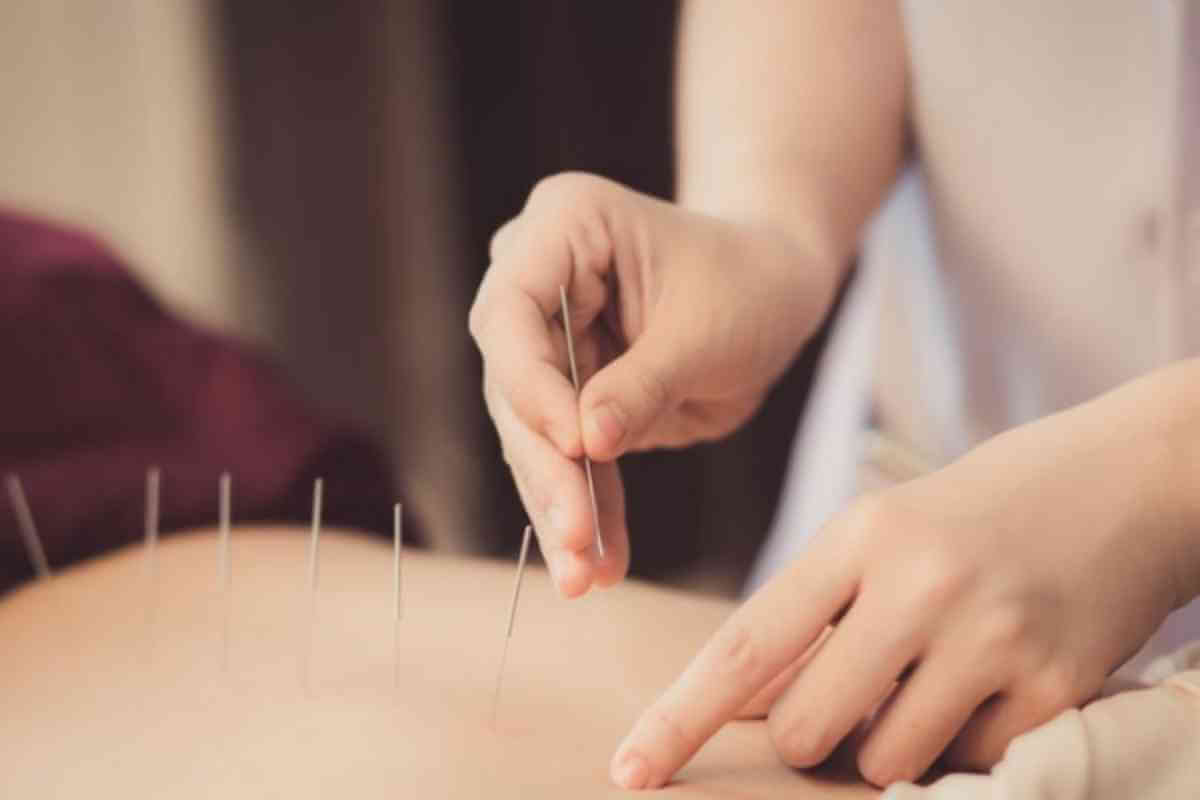 acupuntura-tratamento-ortopedico